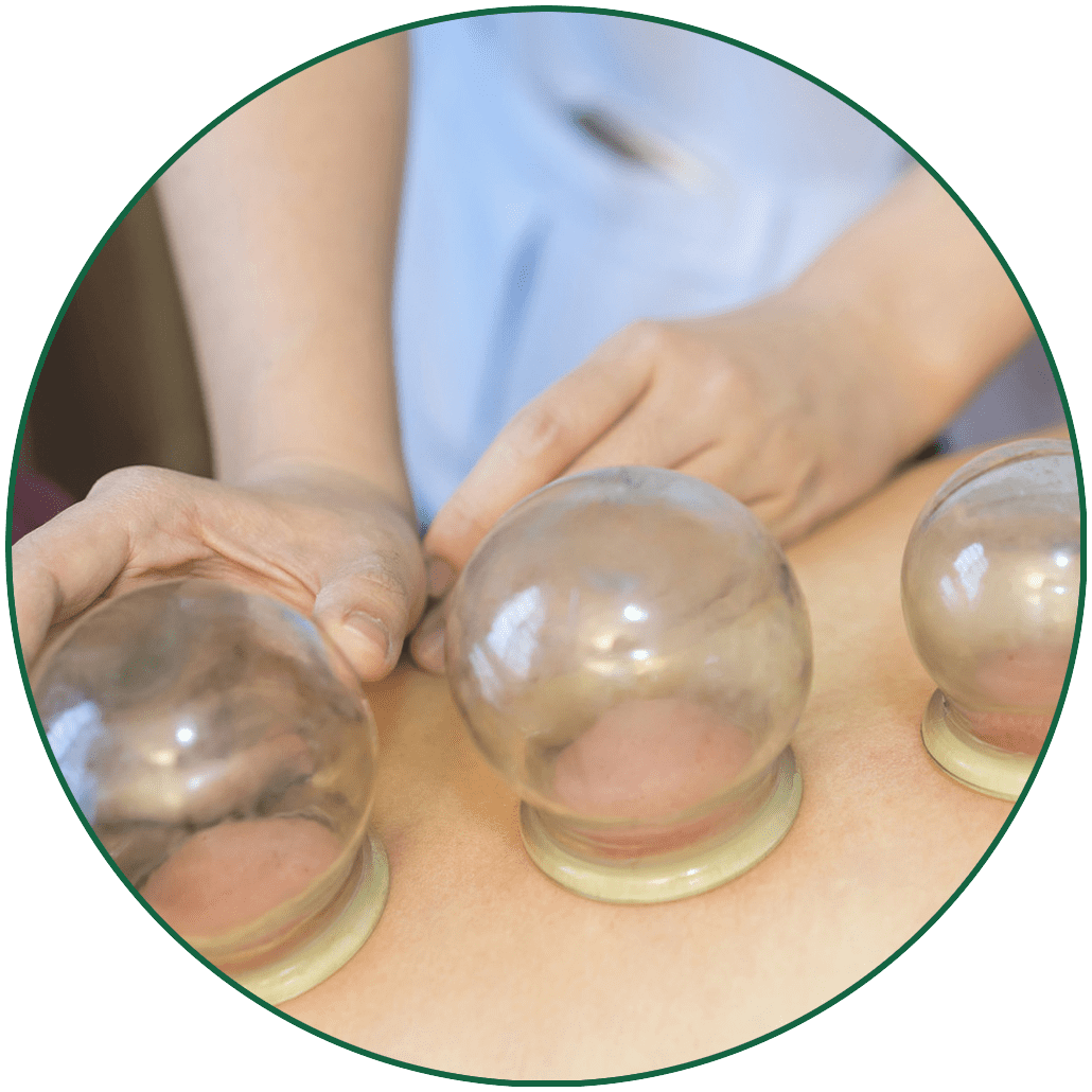 soft cupping